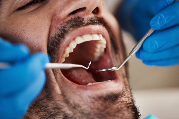 Best Teeth Whitening  in South Charleston, WV